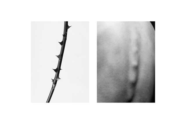 Spine